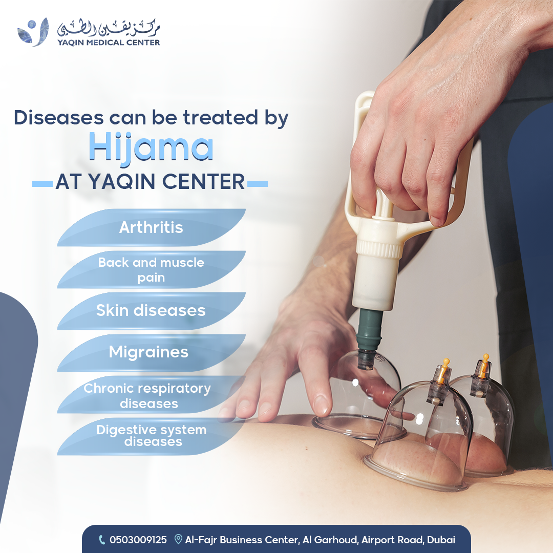 cupping therapy - Copy